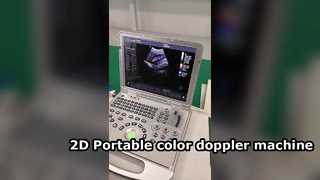 Máy doppler màu cầm tay US15 Plus 2D
