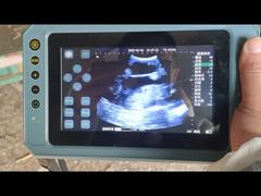 Máy siêu âm thú y cầm tay BR-VET8