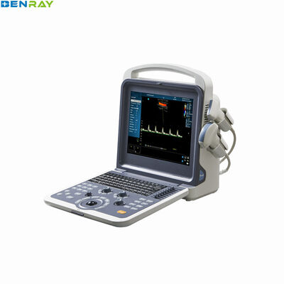 Hệ thống chẩn đoán siêu âm doppler màu cầm tay 80 phần tử