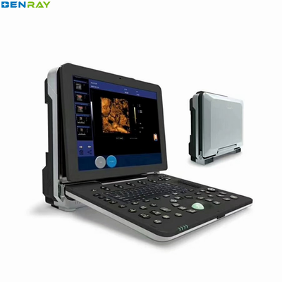 Thiết bị siêu âm y tế Máy Doppler màu cầm tay 4D
