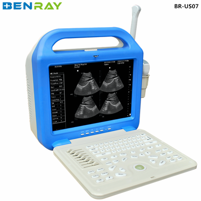 Thiết bị chẩn đoán siêu âm máy tính xách tay kỹ thuật số cho con người