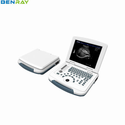 Hệ thống chẩn đoán siêu âm máy tính xách tay kỹ thuật số đầy đủ 96 phần tử