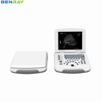 Hệ thống chẩn đoán siêu âm máy tính xách tay kỹ thuật số đầy đủ 80element